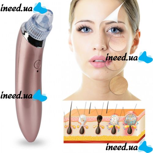 Вакуумний апарат для обличчя Beauty Skin Care Specialist XN-8030 пристрій очищувач, апарат-Очищувач пір для видалення акне, чищення шкіри