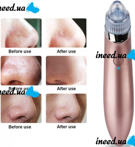 Вакуумний апарат для обличчя Beauty Skin Care Specialist XN-8030 пристрій очищувач, апарат-Очищувач пір для видалення акне, чищення шкіри