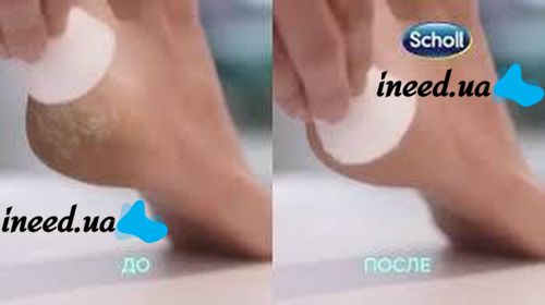 Electric Roller file for feet and feet Scholl Velvet Smoooth Express Pedi, Electric pumice stone for pedicure with roller, Sholl, Shol