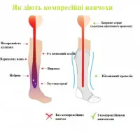 Компрессионные гольфы от варикоза Zip Sox, облегающие лечебные чулки, носки для фиксации лодыжек Зип Сокс со змейкой, Черные S/M, L/XL