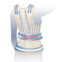 Fixing corrector of correct posture Back Pain Need Help Thoracolumbar corset for back and shoulder alignment, bandage, vest belt for the spine