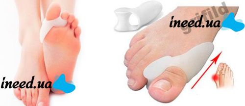 Фіксатор для корекції великих пальців Valgus Pro Коректор кісточки коректор