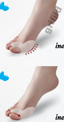 Фіксатор для корекції великих пальців Valgus Pro Коректор кісточки коректор