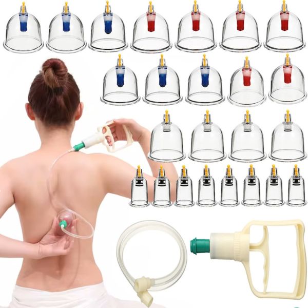 Feipujian KL-32 vacuum jar set for massage anti-cellulite massage jars for the whole body and hijams with KL32 vacuum pump, set of 32 pieces