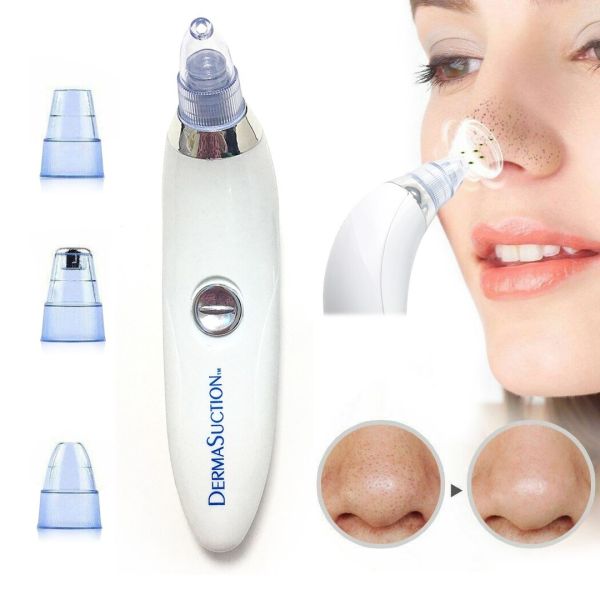 Вакуумный аппарат Derma Suction прибор для чистки пор и удаления черных точек, пилинг для лица, очиститель, аппарат-очиститель кожи 4 насадки Белый
